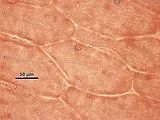 7 - Dettaglio di un filamento midollare con cellula secretrice